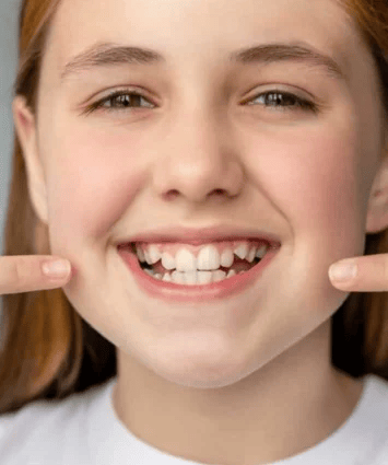       Crooked Teeth